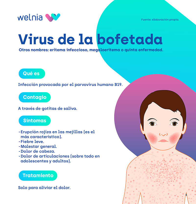  Infografía del virus de la bofetada que explica qué es el eritema infeccioso, cuáles son sus síntomas y cómo se contagia